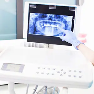 A gloved hand pointing to a digital panoramic dental X-ray displayed on a touchscreen monitor mounted to a medical control unit.